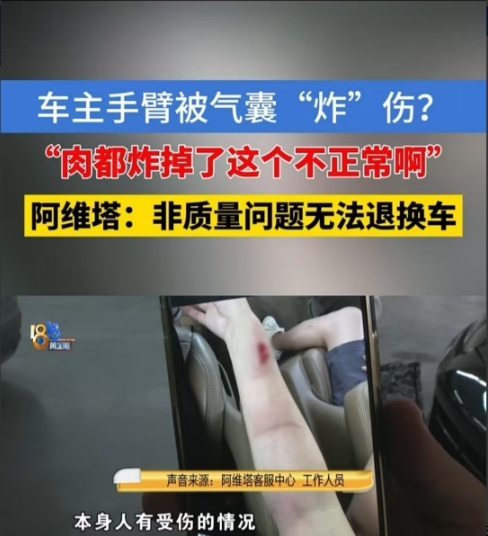浙江，女子开车时发生碰撞，安全气囊没有包裹住方向盘，导致自己的手臂被炸伤。她怀疑