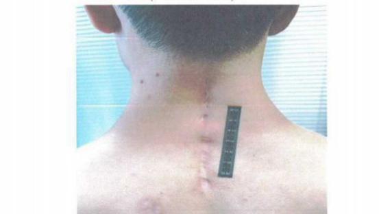 从赛场骑手到五级伤残，吴某廷的500天：谁为赛事安全疏漏负责？