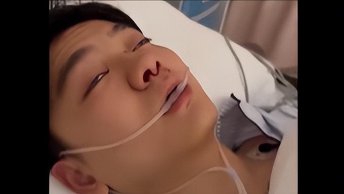 重庆女子遛狗不拴绳，男子质问被打成2级轻伤，小区居民透露真相