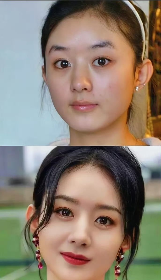 赵丽颖妈生脸，对比太直观
