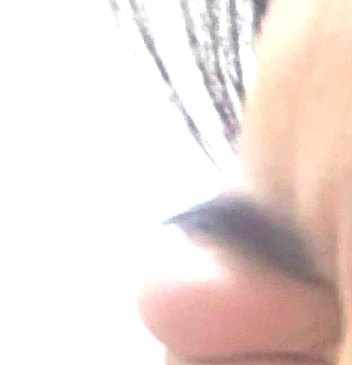 女朋友半夜哭着给我电话，说被蚊子咬了，我说不至于吧，她发了个照片我绷不住了。