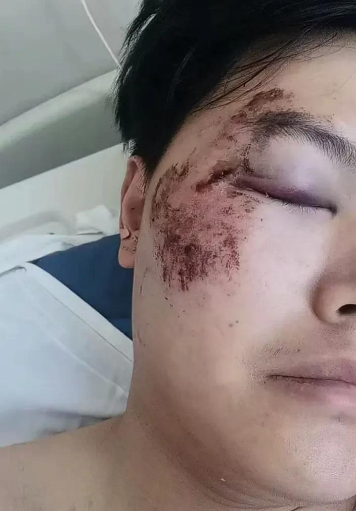 这种事必须提早预防！8月8日，河南郑州一名20岁男子睡觉梦游，突然开窗从3楼跳下
