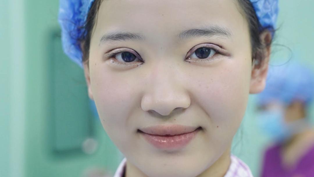 平扇改变能多明显？真人案例：从普通到高级的完美蜕变！