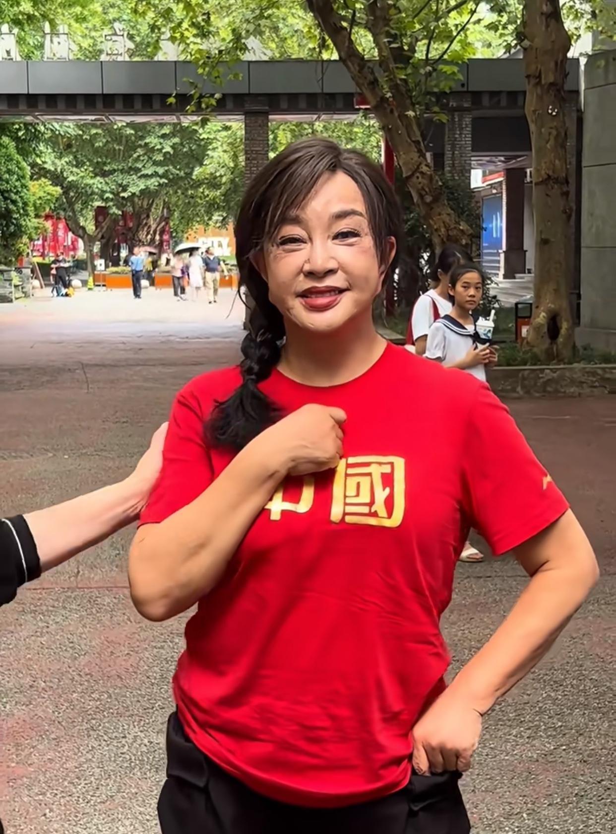 她戴假发吗？
刘晓庆75岁这发量相当可以，
好多人问她的脸怎么了有的地方光滑鬓角