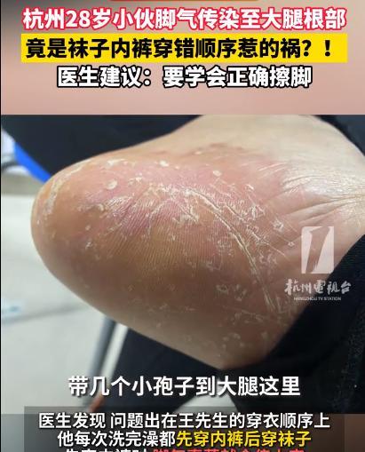 “解释不清了！”杭州，28岁小伙大腿根部奇痒无比，他以为是蚊子咬的，结果，直到出