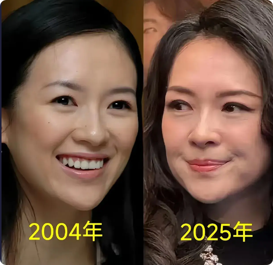 “国际章”还是年老色衰了，人是斗不过年轮的，自然衰老是一个过程，顺其自然就好，不