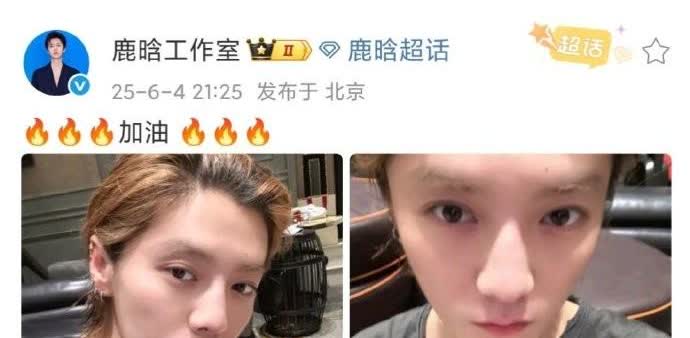 鹿晗这是准备复出了……

突然鹿晗晒出了照片在，这个样子看起来状态不错，没有