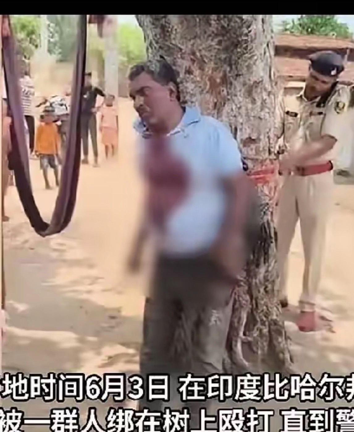 医生帮人却遭报复，被绑树上暴打











怎么也没想到，一个好心救人