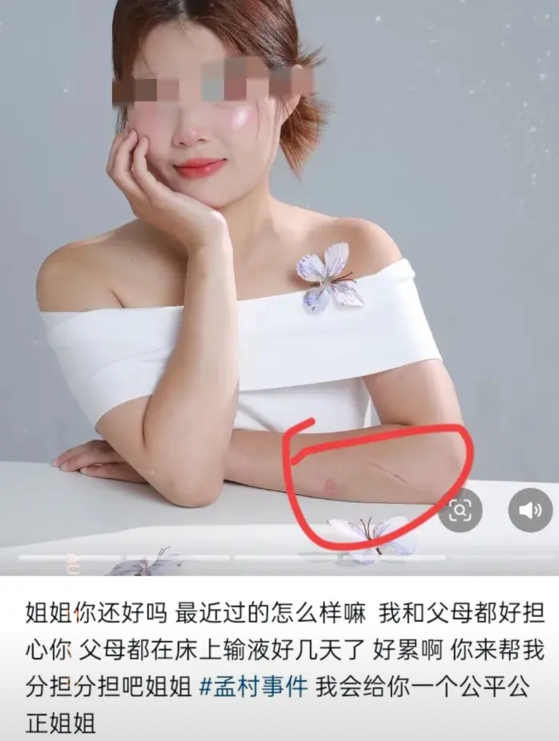 孟村25岁去世女子弟弟在网络平台发布怀念姐姐的图片，令人惊讶的是，这张图片女子打