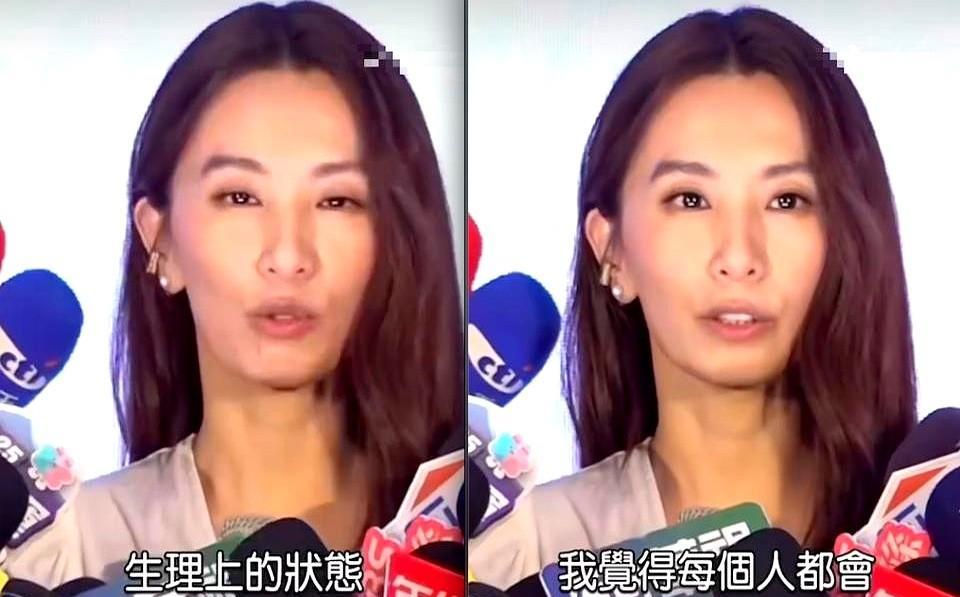 一年间像老了十岁，田馥甄近照下颌骨消瘦缩短，说话时嘴包不住牙
田馥甄接受采访的时