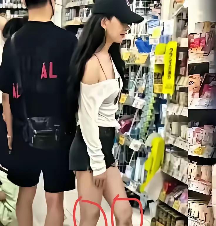 汪峰新女友的这个膝盖黑色部分是咋造成的呢？