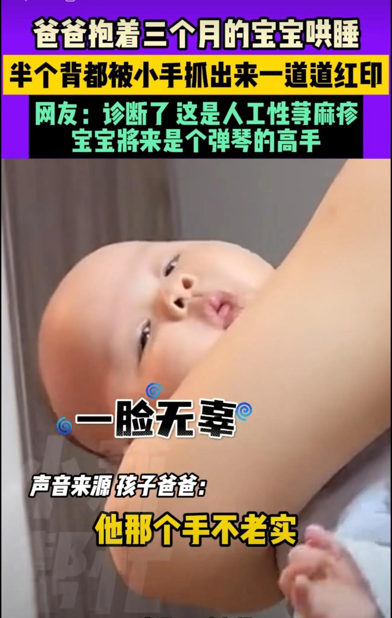 3月24日，辽宁，爸爸抱着三个月的宝宝哄睡，半个背都被小手抓出来一道道红印，网友