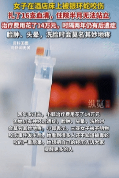 代价太大了！一女子在酒店的床上被银环蛇给咬伤，当时就到医院注射16支血清，本以为