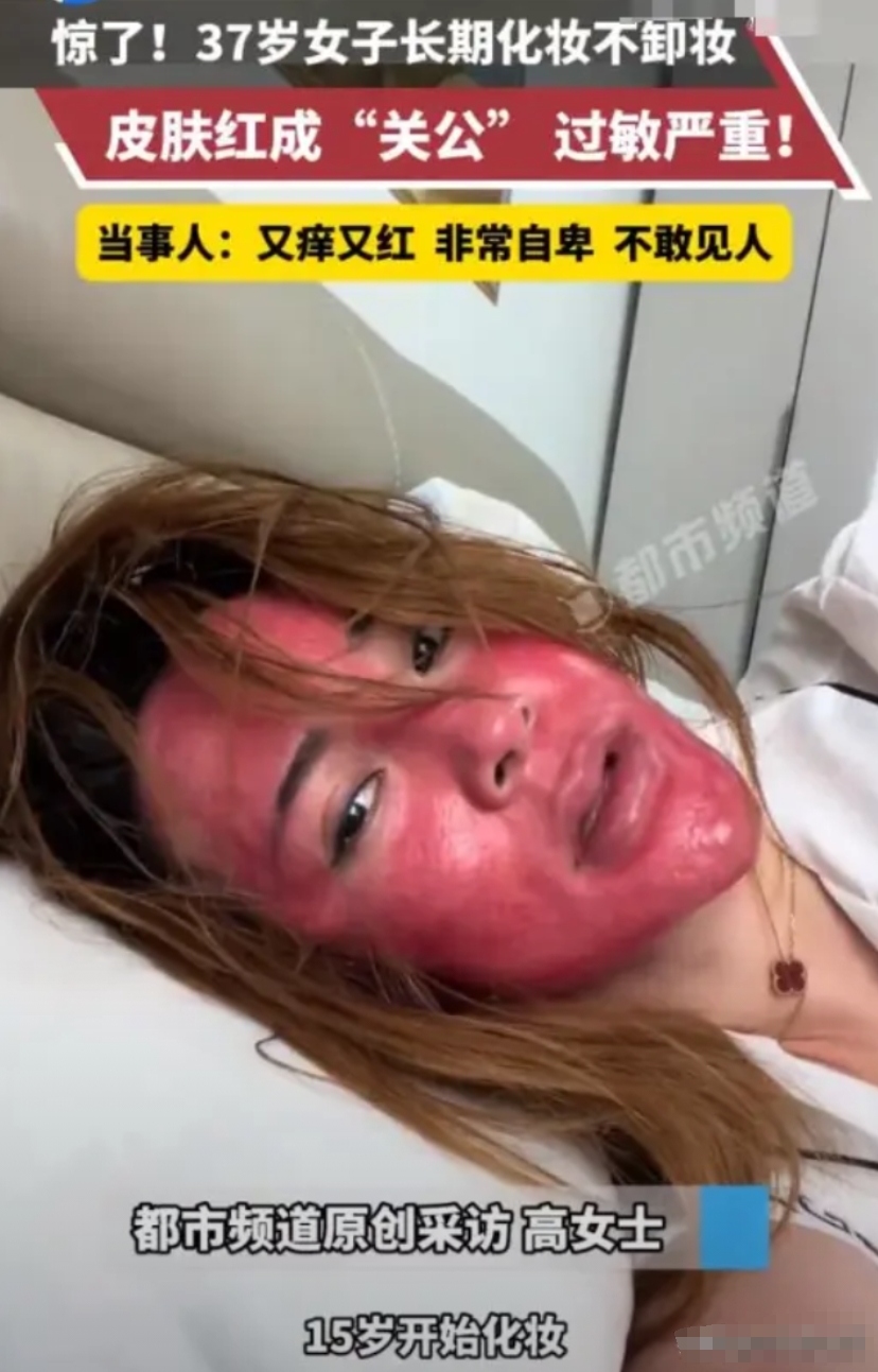 吉林37岁女子从15岁开始化妆，就没有卸过妆。好不容易勤奋一次，心血来潮卸了个妆