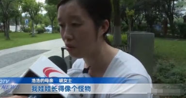 太不容易了！重庆，10个月宝宝生下来就得了罕见病，眼睛大的像灯泡，眼看需要花不少