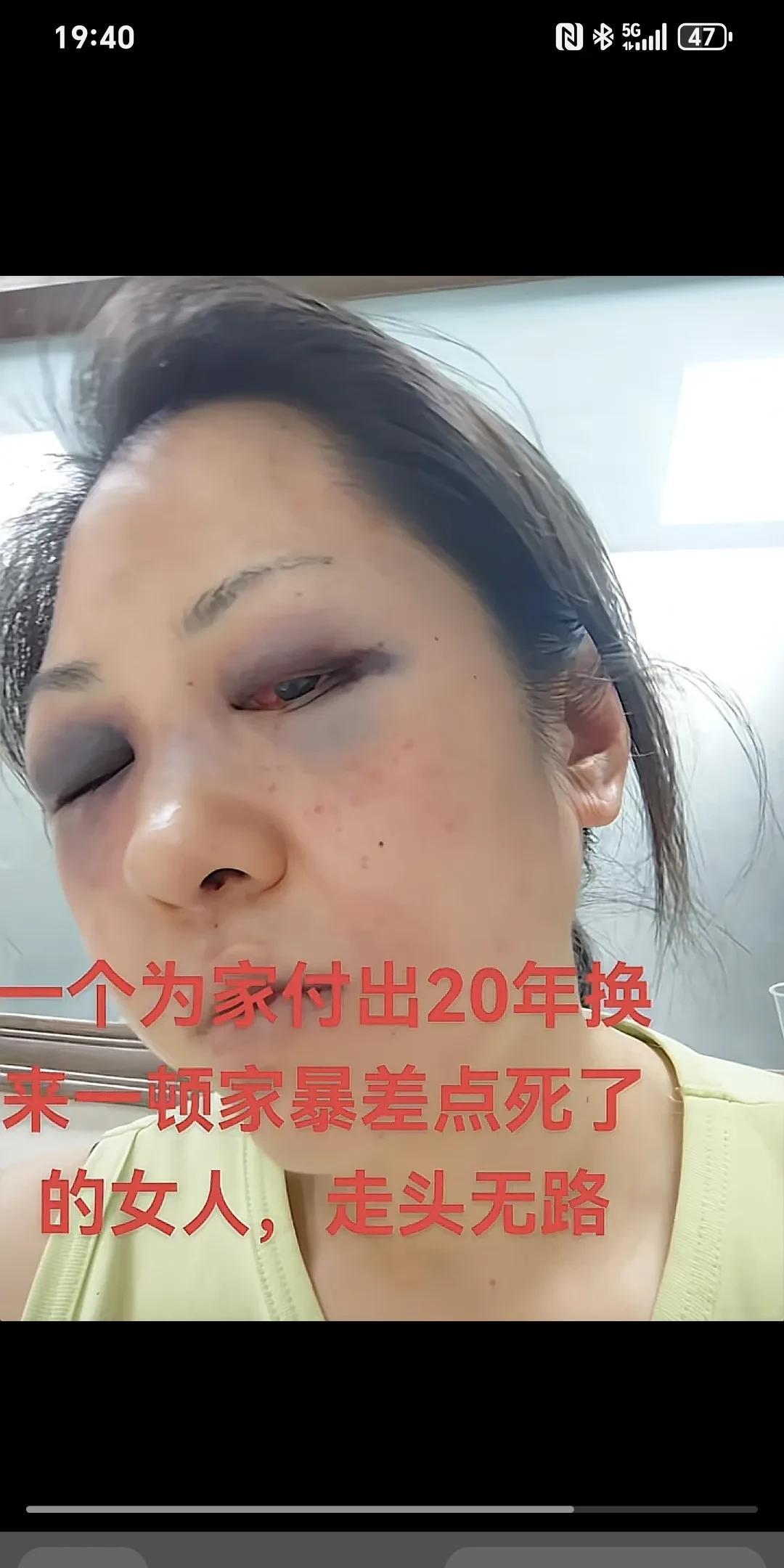 一个为家付出20年换来一顿家暴差点死了的女人，走投无路～
一个为家付出20年换来