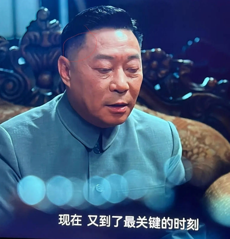 现在的电视剧，为什么每个男人都顶着一头浓密的假发，太假了！为什么不能不戴假发，难
