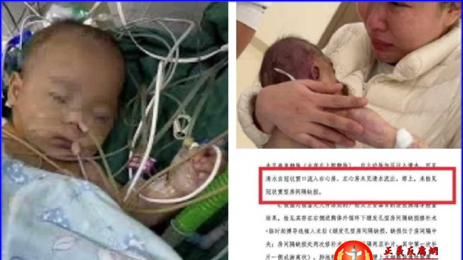 浙江宁波女婴小洛熙尸检报告出炉，手术存在重大失误，院方删除发布情况说明