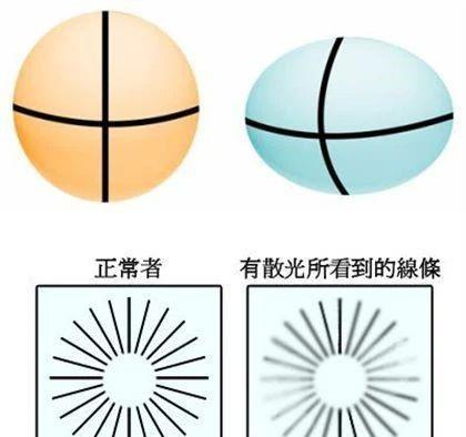 【#导致眼睛散光的3个坏习惯#】正常眼球如完美圆滑的“足球”，各方向屈光度均匀，