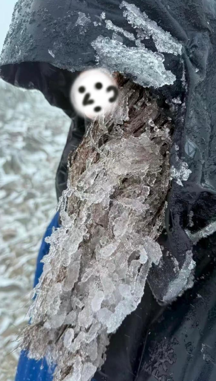 爬雪山不扎头发的下场be like

