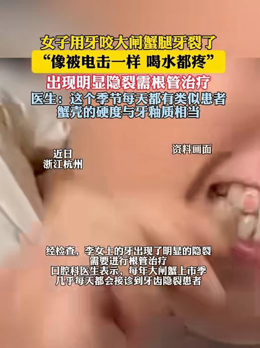 “悲剧还是发生了！”2025年，浙江杭州，一女子在家吃螃蟹，她用牙齿咬开螃蟹腿时