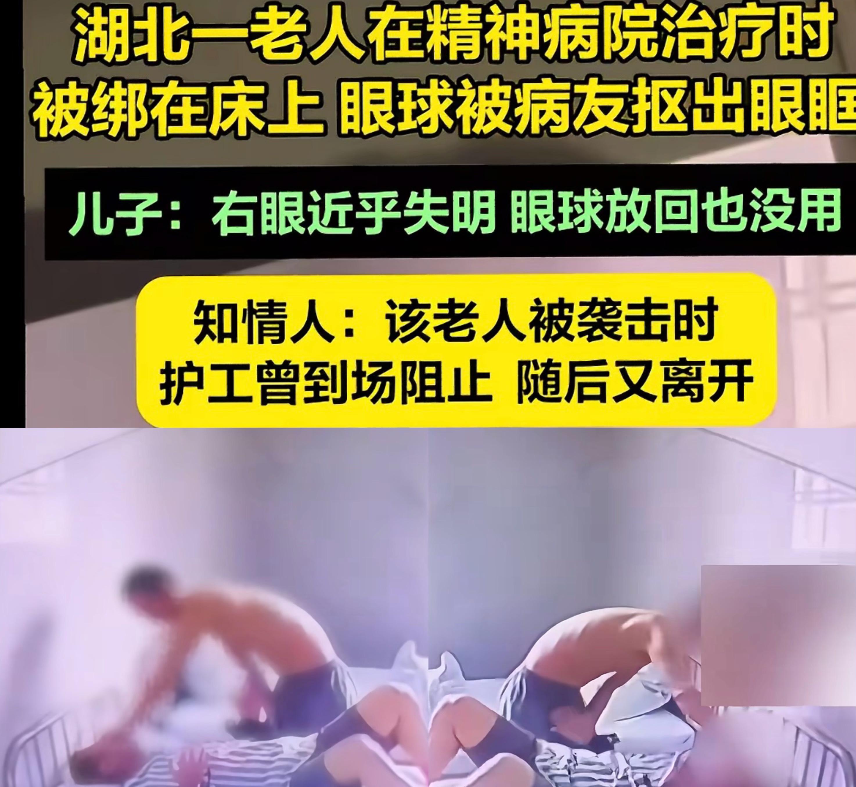 湖北黄石一精神病院，患者王某某遭袭击，眼珠被扣！  令人毛骨悚然的事件发生在湖北