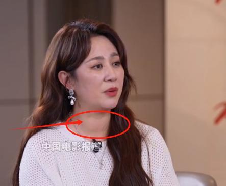 马丽脖子上这是什么？
以前看她的时候，只注意到了她脖子有点短，也有点粗，不过这是