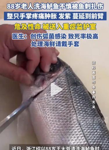 “差点把命搭进去！”浙江，一88岁的大爷在家里处理海鲈鱼，右手不小心被鱼刺扎了一