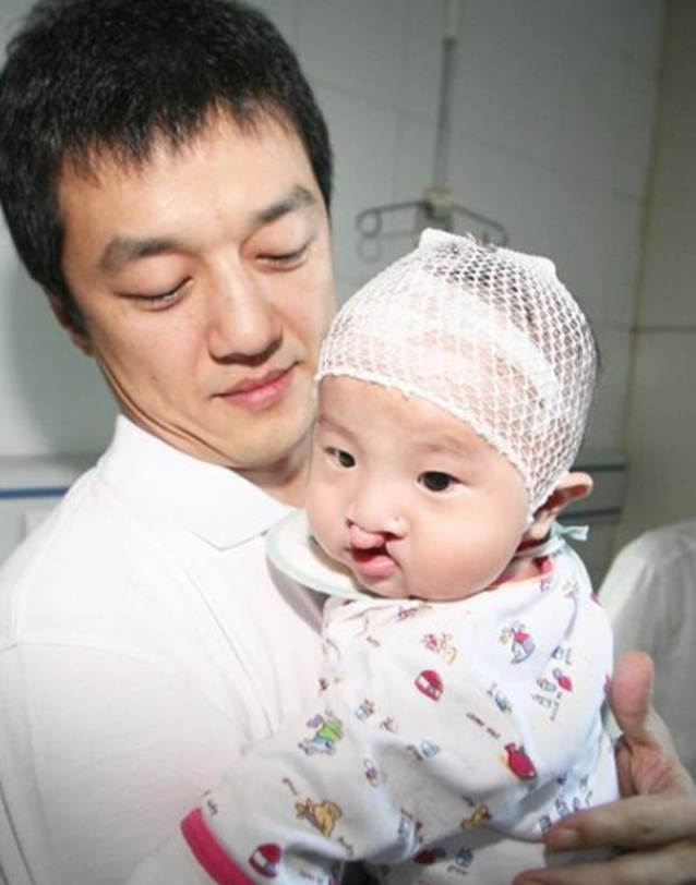 2005年，王菲怀孕4个月的时候，医生告诉她和李亚鹏：“孩子有可能是兔唇”回到家