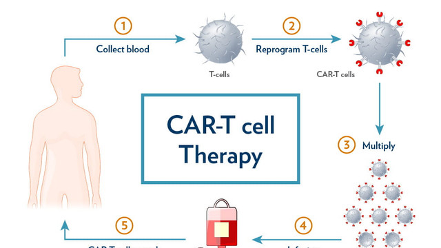 “谈成了！”百万一针的CAR-T有望飞入寻常百姓家，CAR-T疗法的“天价”门槛，这次真的松动了