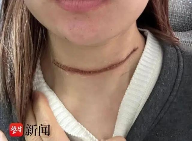 女生被风筝线割喉组委会称签了免责！

近日，南京一女生参加“骑遇盘城”自行车大赛