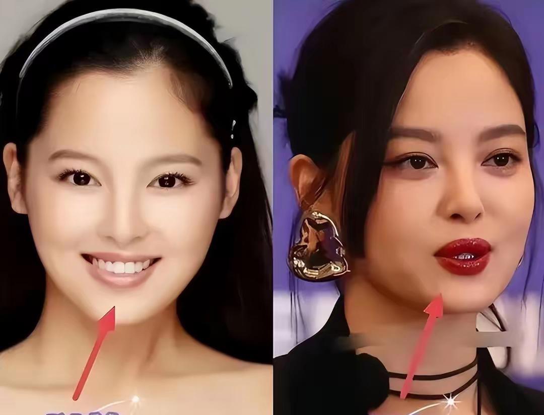 辛芷蕾
背后绝对是有高人指点了吧
原因是以前的她只是一个普普通通的美女，嘴唇这么