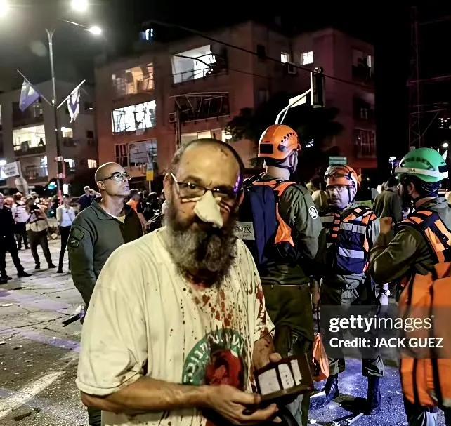 伊朗大规模反击打疼以色列了吗？这个事件其实值得从战略威慑的成本博弈视角来看。当伊