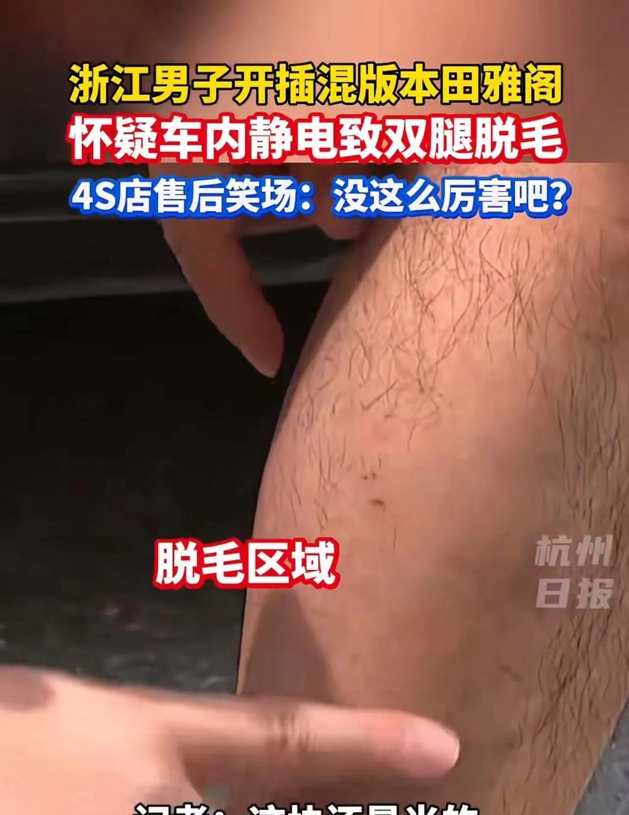 浙江绍兴，男子怀疑汽车静电导致双腿脱毛，去4S店讨说法时，售后主管忍不住笑场：“