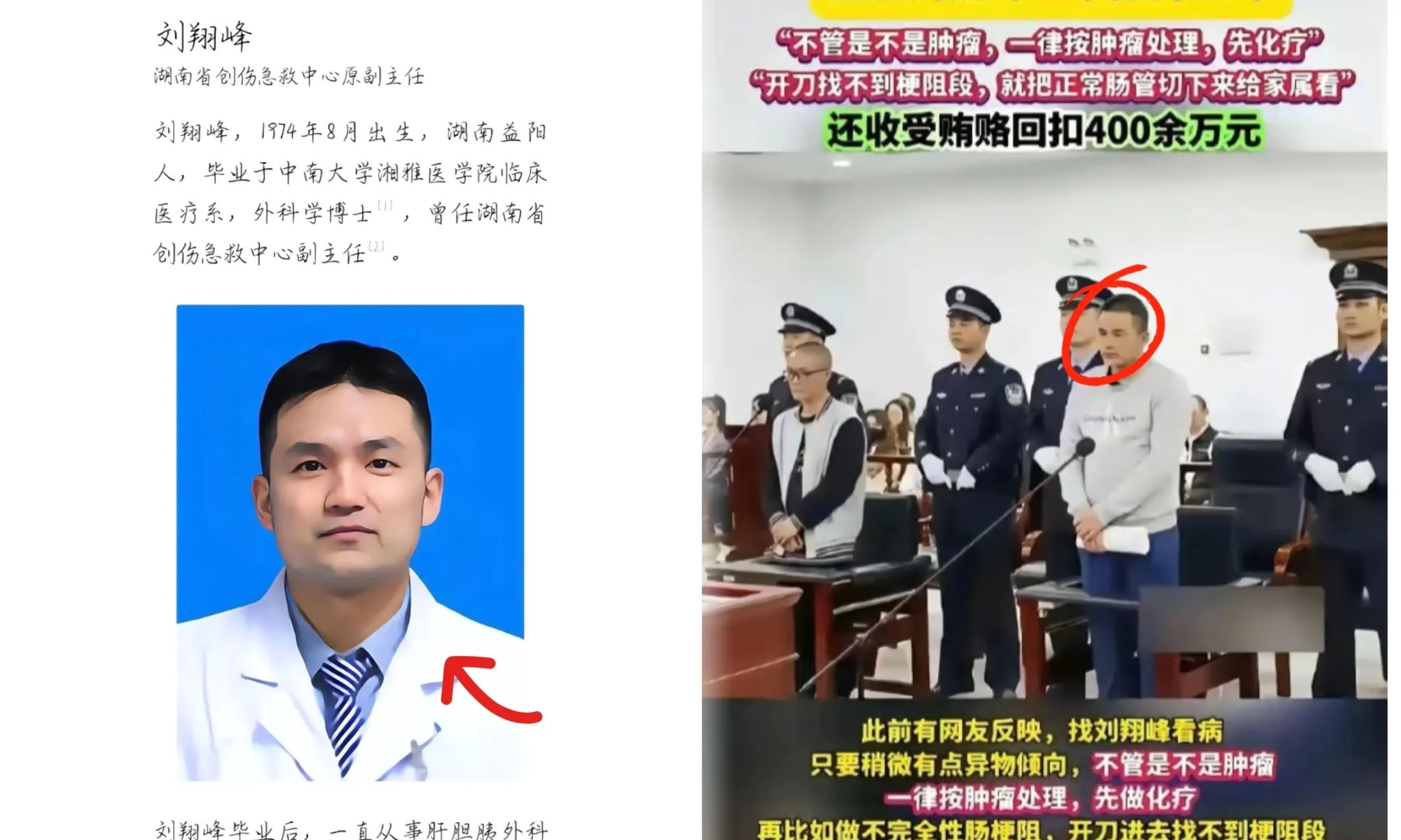 “不管是不是肿瘤，一律按肿瘤处理，先化疗”，“开刀找不到梗阻段，就把正常肠管切下