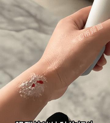 家里有这种拖把的一定要格外小心！女子在家拖地时，拖把头意外掉落，钢管口瞬间把手腕