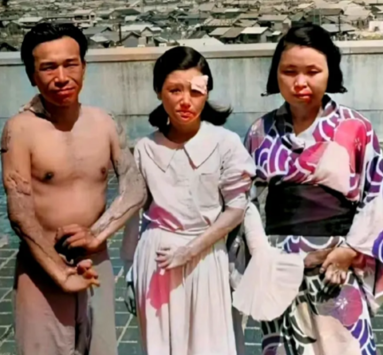 1945年，广岛原子弹爆炸后，三个幸存者，留下了这一张照片，镜头中的他们眼神非常
