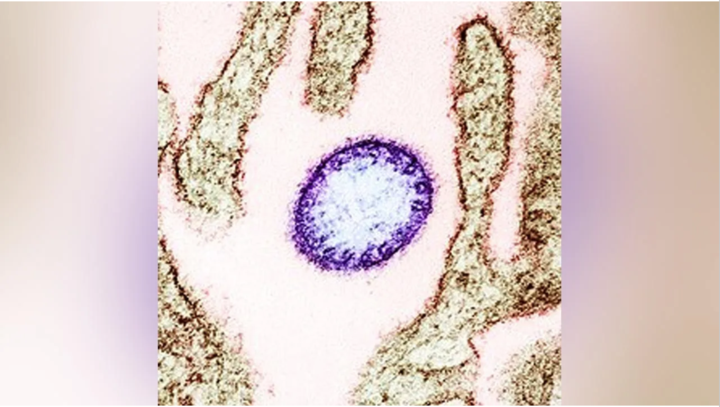 印度尼帕病毒疫情爆发后，马来西亚加强入境点筛查