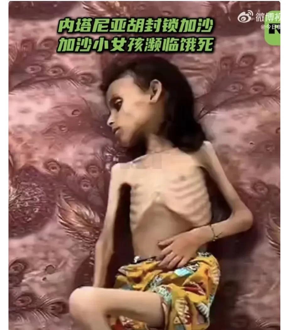 以色列总理内塔尼亚胡表示，“加沙地带不存在饥饿政策，加沙地带也不存在饥荒”。 