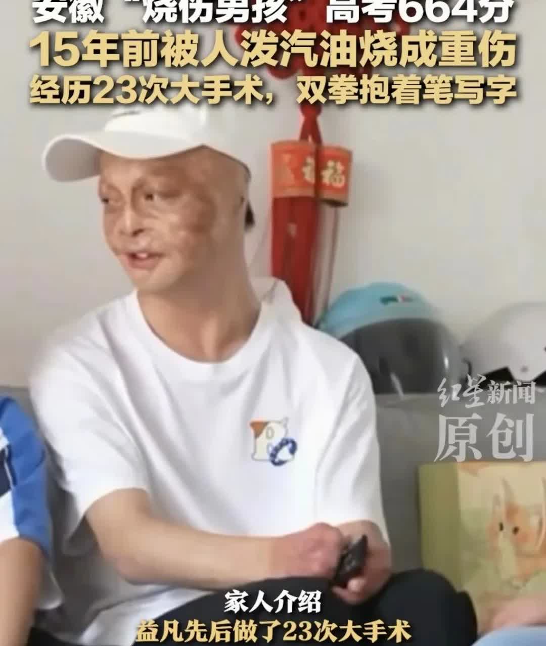 烧伤男孩方益凡高考664分
安徽男孩方益凡6岁是在舅舅家做客，因舅舅与一名男子