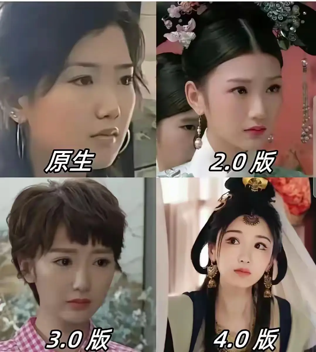 2.0真的好看，但是整容后是不是要定期维护才不垮掉？
