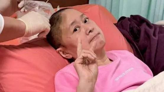 《流星花园》杉菜妈妈王月劫后余生！开颅术后将补头盖骨