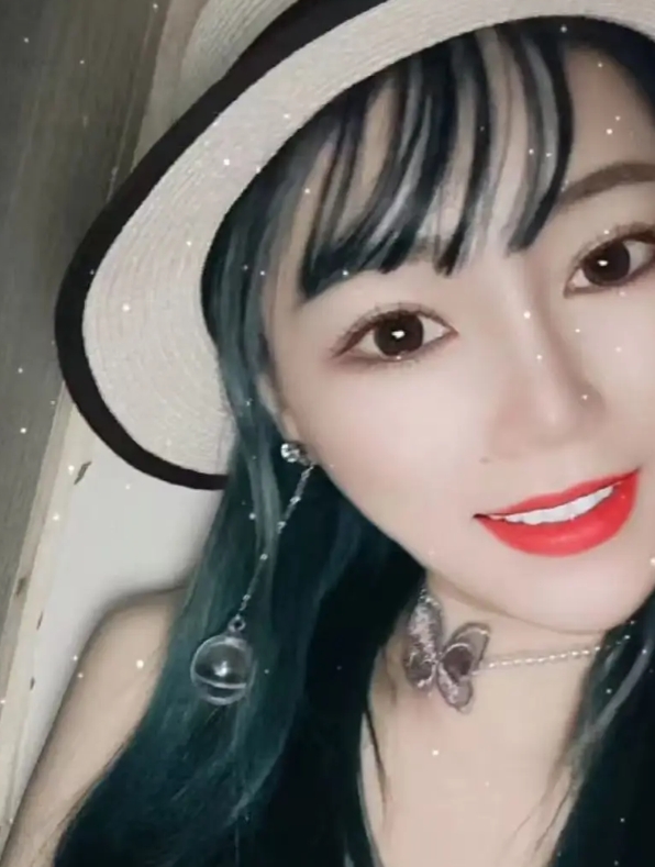 90后驻唱女歌手余文丽因脑血管破裂去世。生前她患有糖尿病，已接受4年透析治疗。