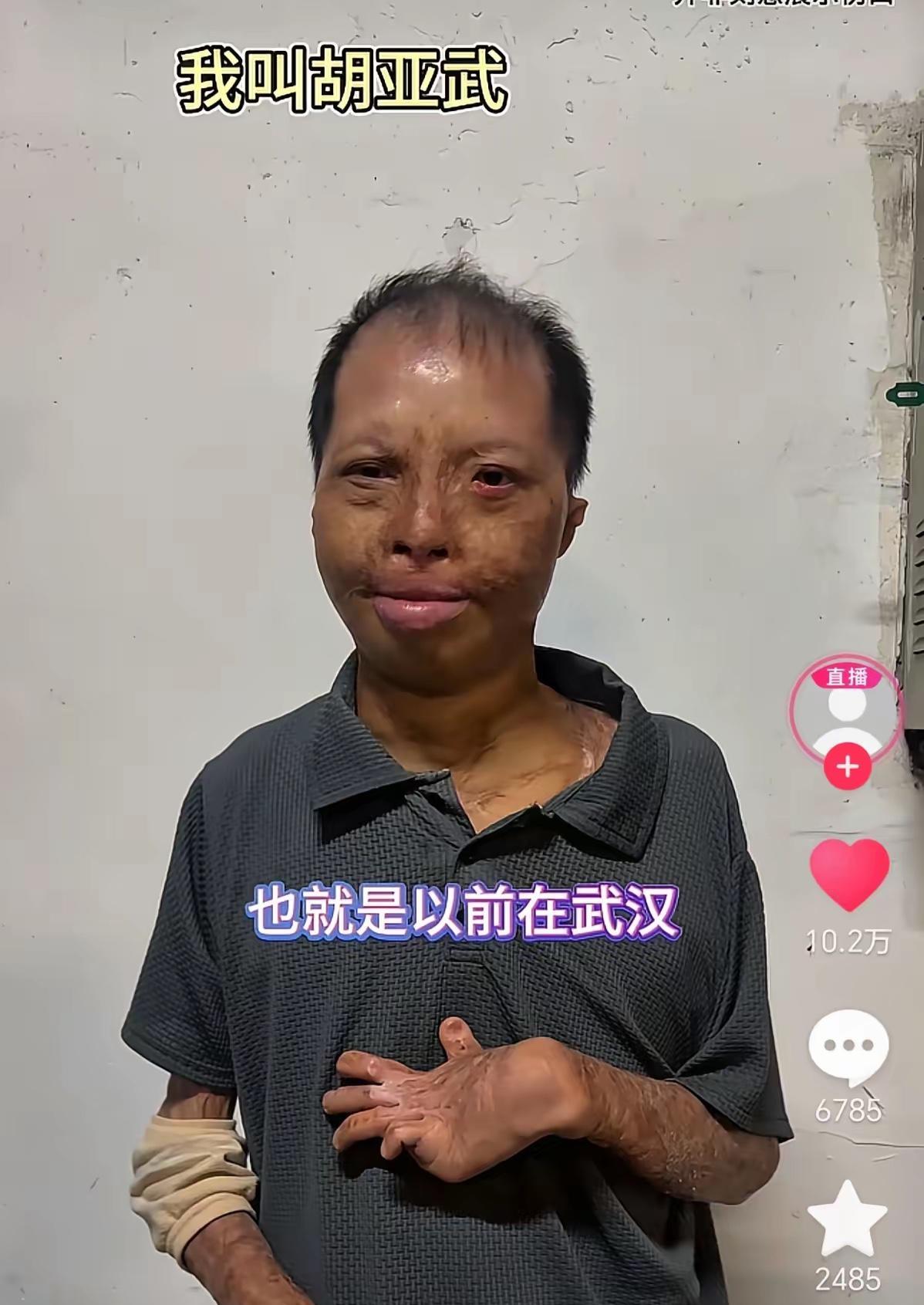 向中国最美男哥手，人民英雄胡亚武致敬！
“最美男哥手”这五个字，听起来像选秀节目