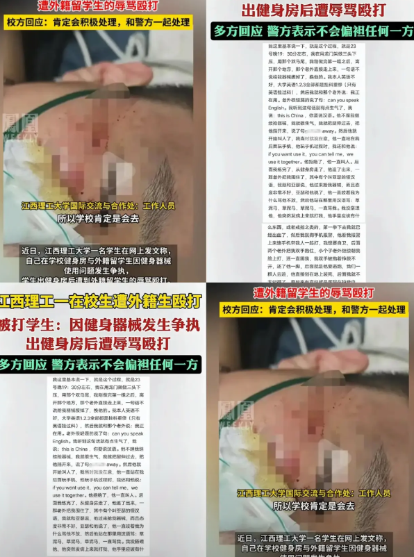 江西，大学生遭外籍留学生辱骂殴打，挖出几个细节：

男生被留学生殴打，脸部受重伤