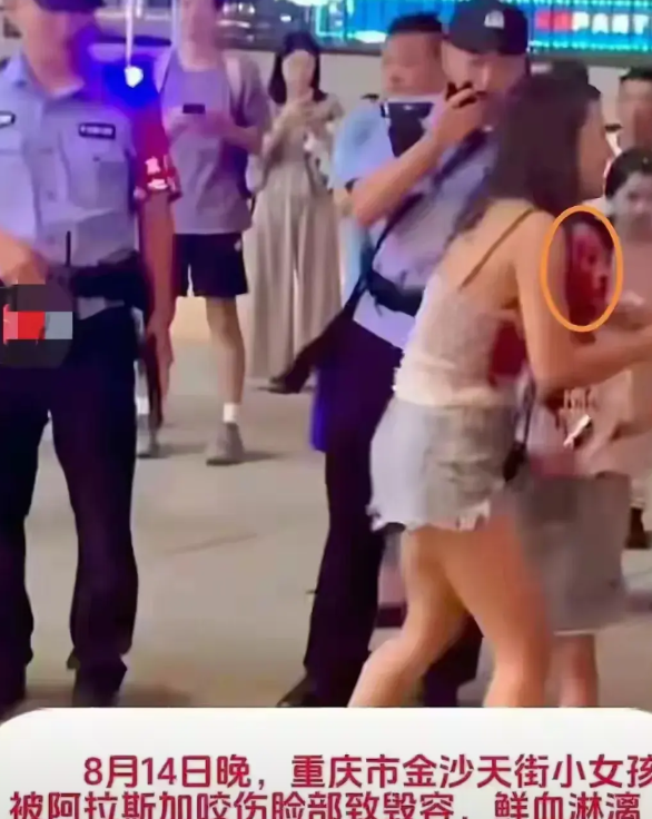 百斤大狗撕咬女孩后续：治疗费约30万，狗主人和女孩家长见面。

重庆沙坪坝三峡广