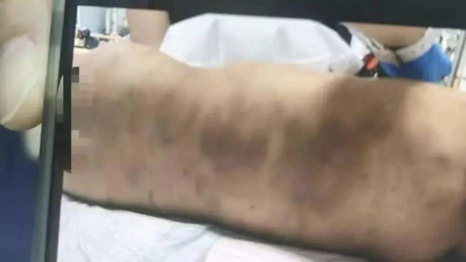 上海幼童遭虐致死案开庭 律师解析量刑关键