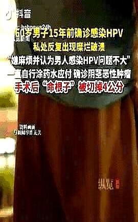 命根子被切掉4公分！
杭州，一男子和女子亲密接触时没做好安全措施，事后，私处出现