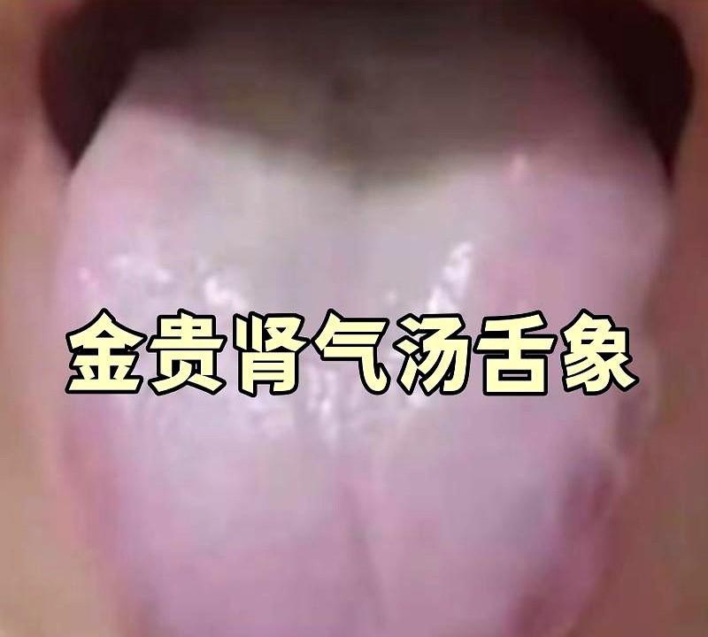 上午继续，伸舌我看！
1分钟告知结果和调理方向，保证一个不漏！
咱们的舌头啊，可