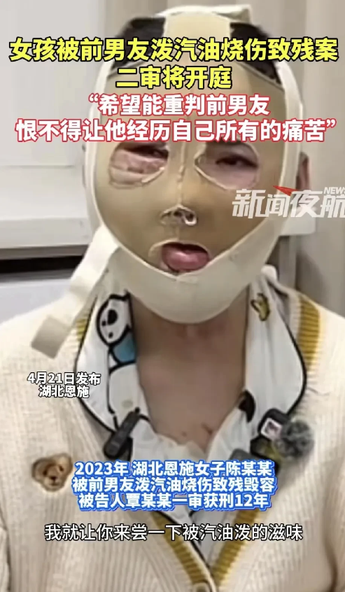 恩施烧伤案二审，网友态度引热议
